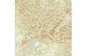 EAST CROOKED LAKE, MN